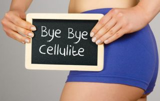 Cellulite, la soluzione è su misura. Anche per le giovanissime